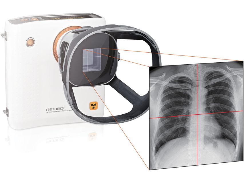 Camera raggi-x portatile con collimatore  REMEX KA6
