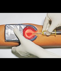 Rilevatore vene portatile  Veinspy