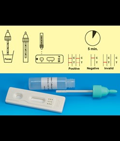 TEST FOB - Sangue occulto nelle feci