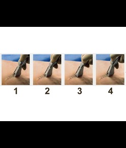 Suturatrice cutanea  3M Precise