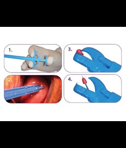 Pinze per biopsia cervicale