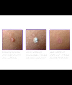 Dispositivo di chirurgia