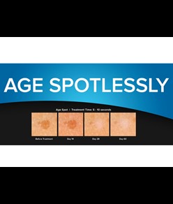 Dispositivo chirurgico