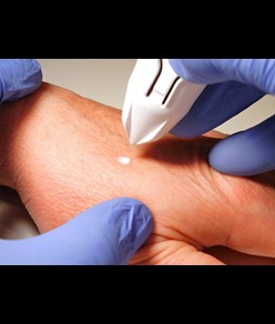 Dispositivo chirurgico