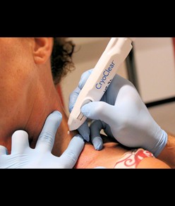 Dispositivo chirurgico