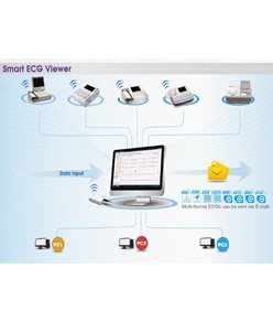 Software ECG Software ECG