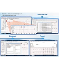 Software ECG Software ECG