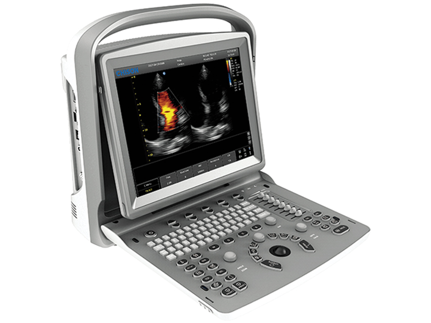Colordoppler Chison ECO5