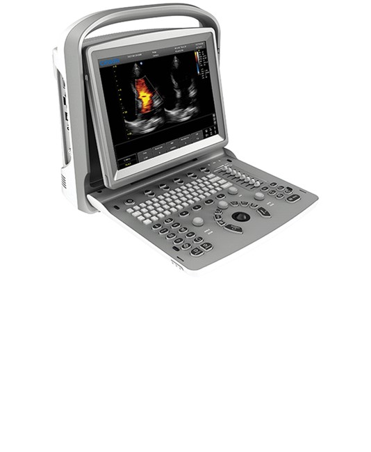 Colordoppler Chison ECO5 Colordoppler Chison ECO5