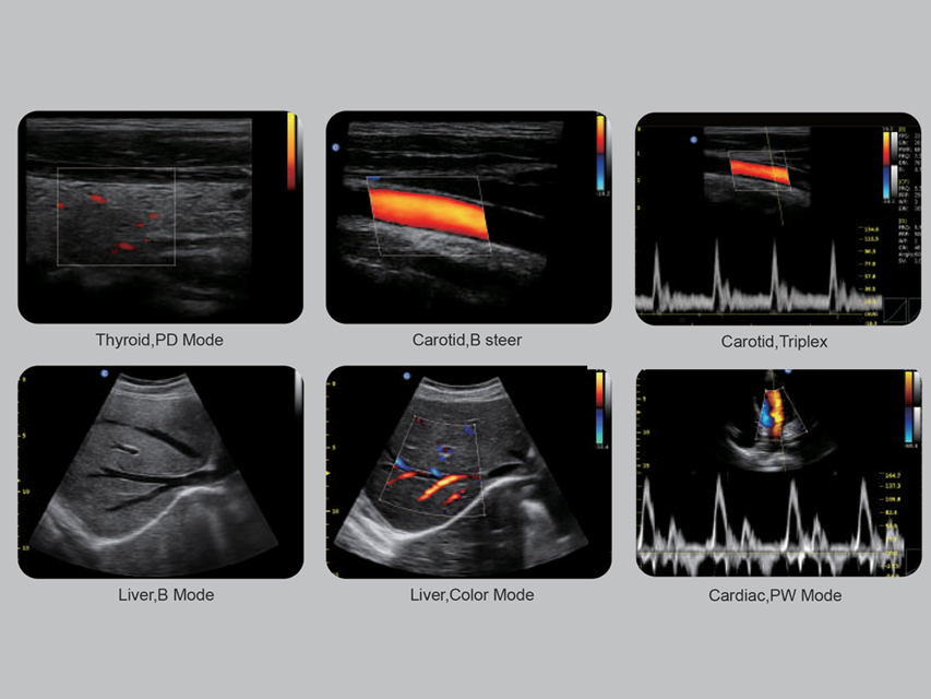 Colordoppler Chison ECO5