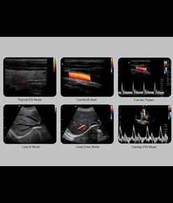 Colordoppler Chison ECO5