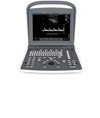 Ecografo Chison ECO2 Ecografo Chison ECO2