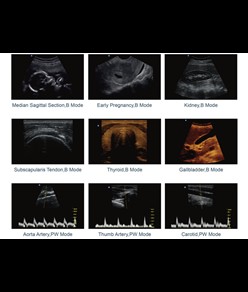 Ecografo Chison ECO2