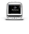 Ecografo Chison ECO3EXP Ecografo Chison ECO3EXP