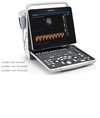 Ecografo portatile Mindray Z50 Ecografo portatile Mindray Z50