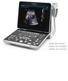 Ecografo portatile Mindray Z50 Ecografo portatile Mindray Z50