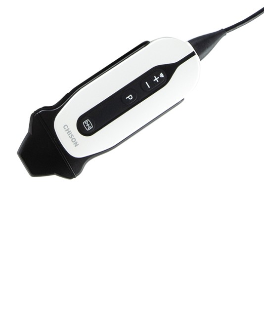 Ecodoppler cardiaca Ecodoppler cardiaca