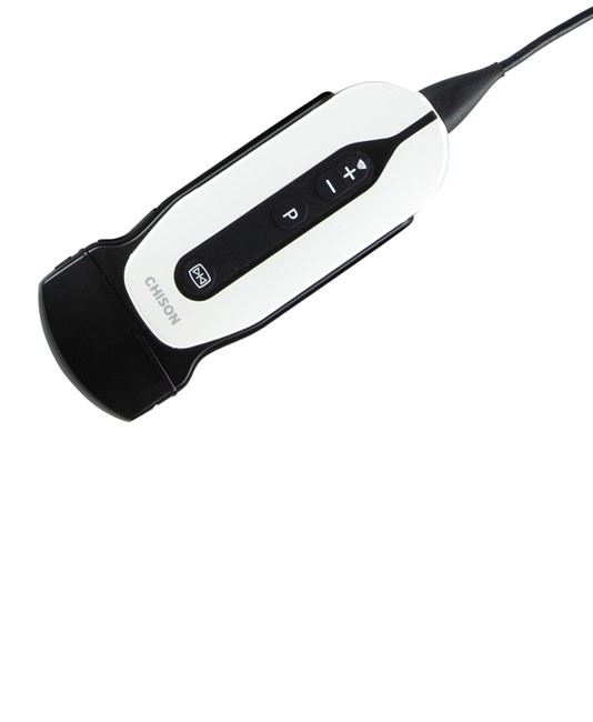 Ecodoppler convessa Ecodoppler convessa