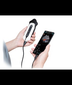 Ecodoppler micro convessa