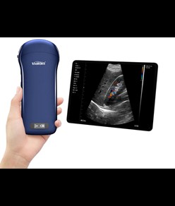 Ecografo portatile