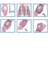 RETE TUBOLARE ELASTICA - calibro 2 per polso e mano