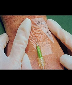 medicazioni Tegaderm