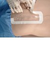 medicazioni Tegaderm medicazioni Tegaderm