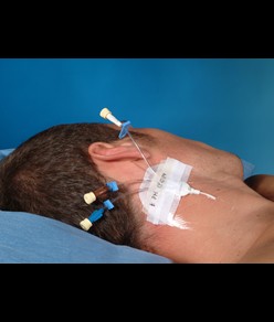 medicazioni Tegaderm IV