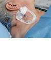 medicazioni di fissaggio Tegaderm IV ADVANCED medicazioni di fissaggio Tegaderm IV ADVANCED