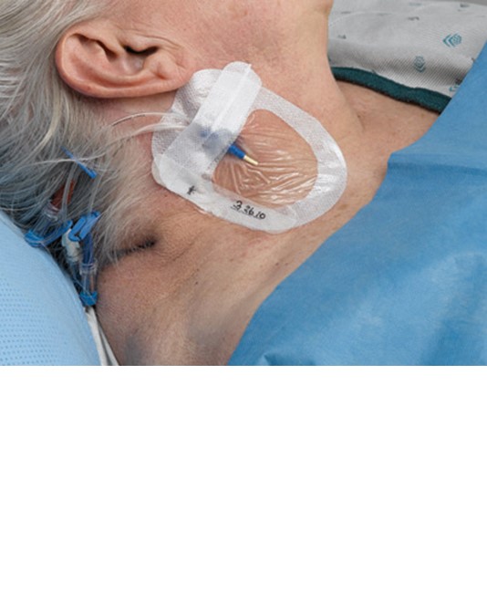 medicazioni di fissaggio Tegaderm IV ADVANCED medicazioni di fissaggio Tegaderm IV ADVANCED