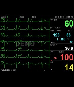 Monitor multiparametrico PC-3000