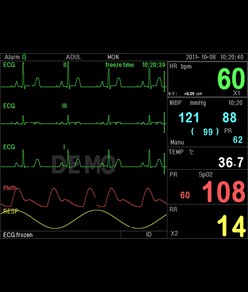 Monitor multiparametrico PC-3000