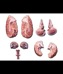 Modello cervello con arterie