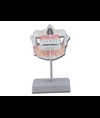 DENTATURA PERMANENTE
