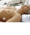 elettrodi ECG elettrodi ECG