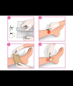 medicazioni non adesive Inadine