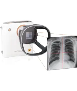 Camera raggi-x portatile con collimatore  REMEX KA6