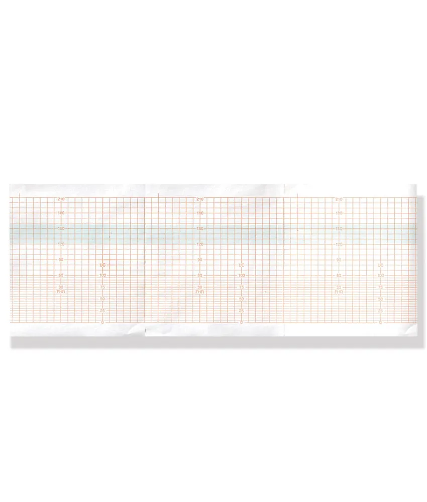 20 pezzi Carta per monitor, fogli: 150 - 100x112 mm