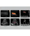 Colordoppler Chison ECO5
