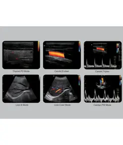 Colordoppler Chison ECO5