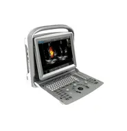 Ecografo portatile Chison