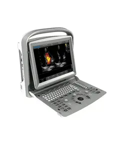Colordoppler Chison ECO5