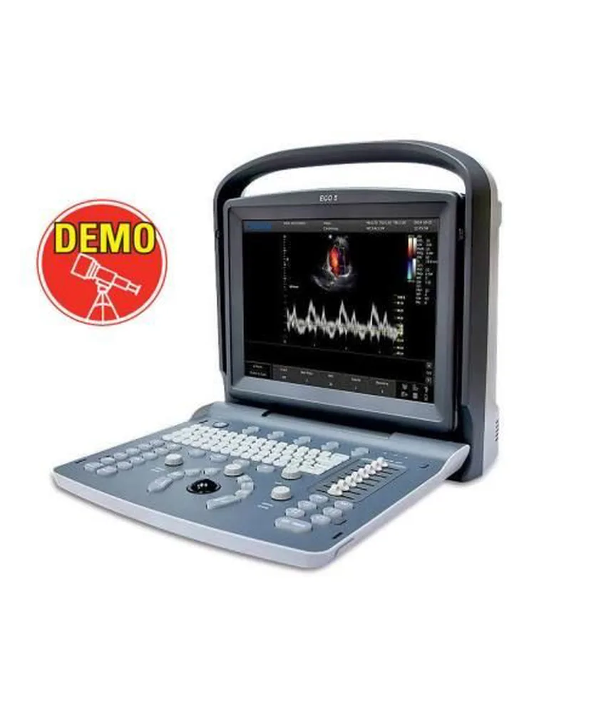 Colordoppler Chison ECO5, alta risoluzione