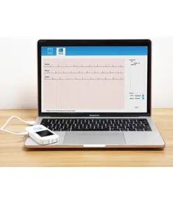 ECG palmare
