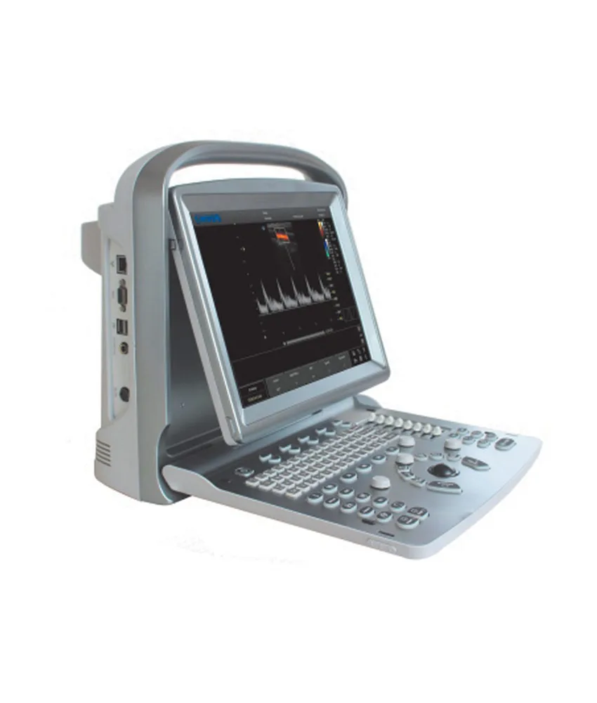 Ecocolordoppler Chison, schermo: 12” LED a colori alta risoluzione 1.024x768
