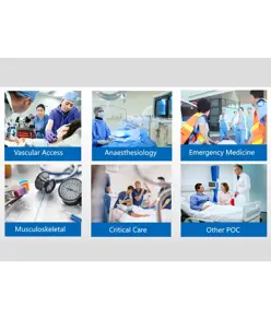 Ecodoppler convessa