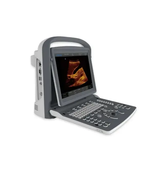 Ecografi digitali Chison