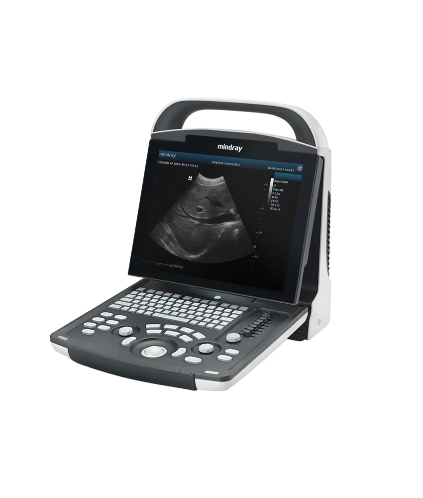Ecografo digitale Mindray DP-10, 2 porte USB