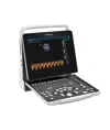 Ecografo portatile Mindray Z50