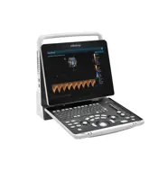 Ecografo portatile Mindray